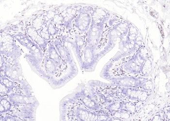 Phospho-ATF2 (Thr71) Recombinant Rabbit Monoclonal Antibody