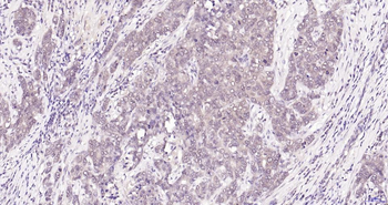 Phospho-Akt (Thr450) Recombinant Rabbit Monoclonal Antibody