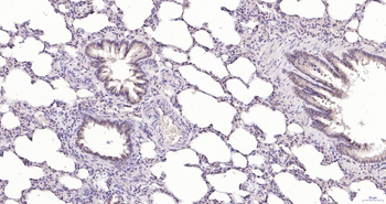 Phospho-Akt (Thr450) Recombinant Rabbit Monoclonal Antibody