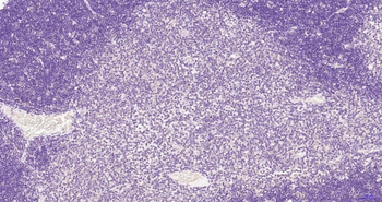 Phospho-Akt (Thr450) Recombinant Rabbit Monoclonal Antibody