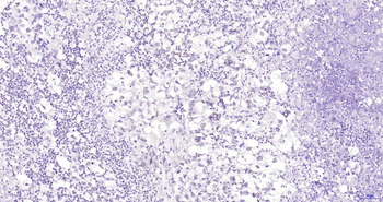 Phospho-Akt (Thr450) Recombinant Rabbit Monoclonal Antibody