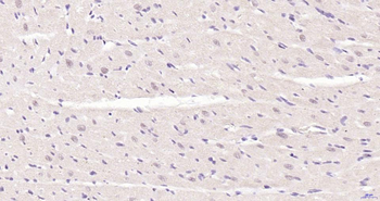 Phospho-Akt (Thr450) Recombinant Rabbit Monoclonal Antibody