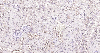 Phospho-Akt (Thr450) Recombinant Rabbit Monoclonal Antibody