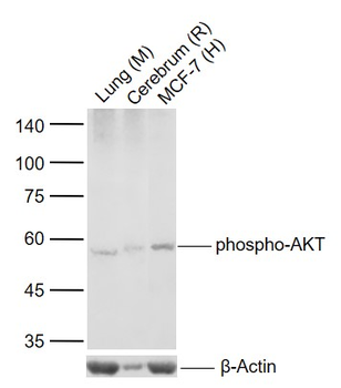 Phospho-AKT (Ser124) Recombinant Rabbit Monoclonal Antibody