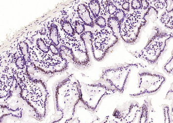 HDAC2 Recombinant Rabbit Monoclonal Antibody