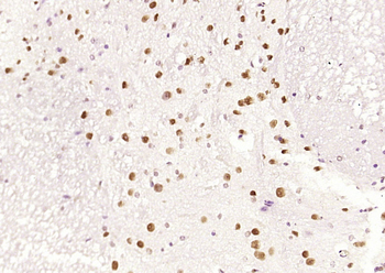 HDAC2 Recombinant Rabbit Monoclonal Antibody