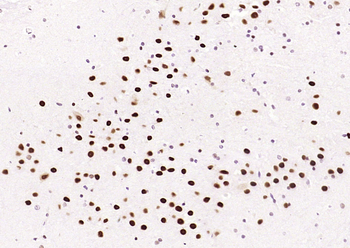 HDAC2 Recombinant Rabbit Monoclonal Antibody