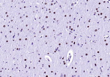 HDAC2 Recombinant Rabbit Monoclonal Antibody
