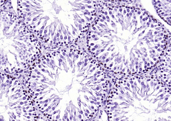 HDAC2 Recombinant Rabbit Monoclonal Antibody