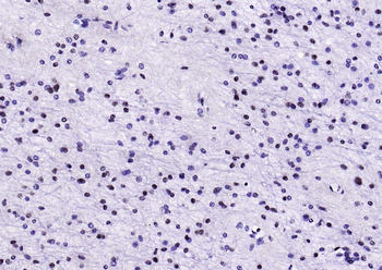 HDAC2 Recombinant Rabbit Monoclonal Antibody