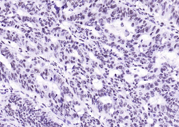 HDAC2 Recombinant Rabbit Monoclonal Antibody