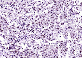 HDAC2 Recombinant Rabbit Monoclonal Antibody