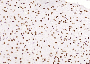 HDAC2 Recombinant Rabbit Monoclonal Antibody