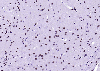 HDAC2 Recombinant Rabbit Monoclonal Antibody