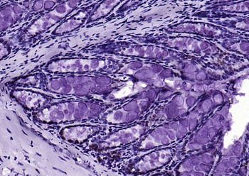 HDAC2 Recombinant Rabbit Monoclonal Antibody