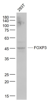 FOXP3 Recombinant Rabbit Monoclonal Antibody
