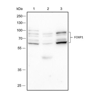 FOXP1 Recombinant Rabbit Monoclonal Antibody