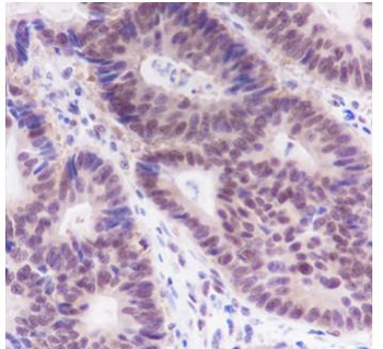 FOXP1 Recombinant Rabbit Monoclonal Antibody