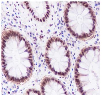 FOXP1 Recombinant Rabbit Monoclonal Antibody