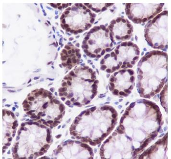 FOXP1 Recombinant Rabbit Monoclonal Antibody