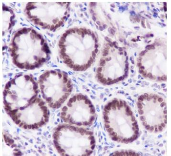 FOXP1 Recombinant Rabbit Monoclonal Antibody
