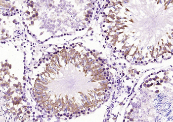 ERK5 Recombinant Rabbit Monoclonal Antibody