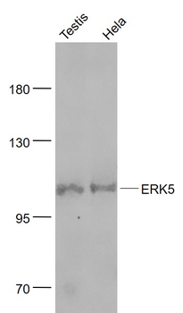ERK5 Recombinant Rabbit Monoclonal Antibody