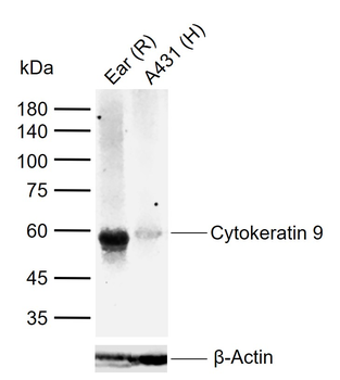 Cytokeratin 9 Recombinant Rabbit Monoclonal Antibody