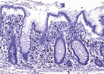 C-Kit Recombinant Rabbit Monoclonal Antibody