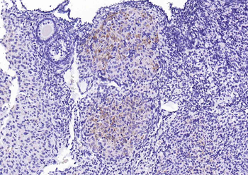 C-Kit Recombinant Rabbit Monoclonal Antibody