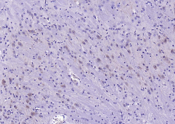 C-Kit Recombinant Rabbit Monoclonal Antibody