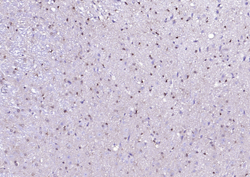 C-Fos Recombinant Rabbit Monoclonal Antibody