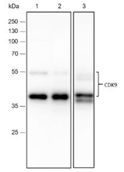 Cdk9 Recombinant Rabbit Monoclonal Antibody