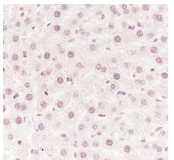 Cdk9 Recombinant Rabbit Monoclonal Antibody