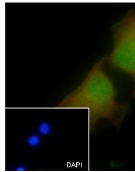 Cdk6 Recombinant Rabbit Monoclonal Antibody