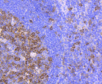 CDK1 Recombinant Rabbit Monoclonal Antibody