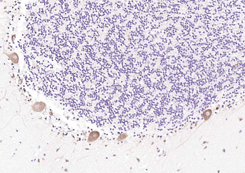 RPS6 (N-term) Mouse Monoclonal Antibody