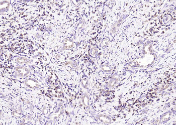 RPS6 (N-term) Mouse Monoclonal Antibody