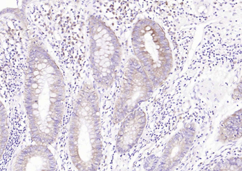 RPS6 (N-term) Mouse Monoclonal Antibody