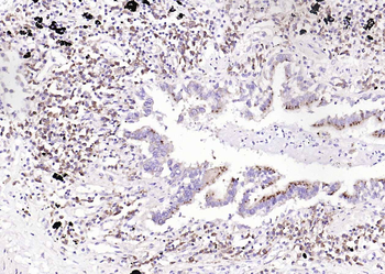 RPS6 (N-term) Mouse Monoclonal Antibody