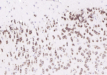 RPS6 (N-term) Mouse Monoclonal Antibody
