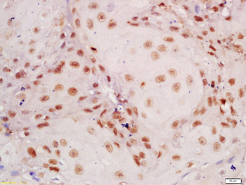 UAP56 Rabbit Polyclonal Antibody