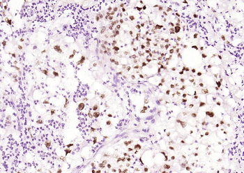 Phospho-HSF1 (Ser326) Recombinant Rabbit Monoclonal Antibody