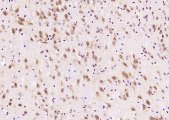 Phospho-HSF1 (Ser326) Recombinant Rabbit Monoclonal Antibody