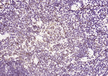 Phospho-HSF1 (Ser326) Recombinant Rabbit Monoclonal Antibody