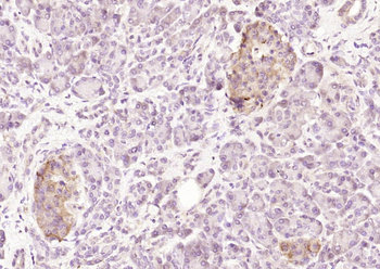 CD151 Rabbit Polyclonal Antibody