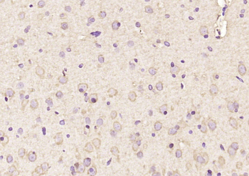 AMPK alpha 2 Rabbit Polyclonal Antibody