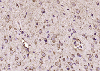 AMPK alpha 2 Rabbit Polyclonal Antibody