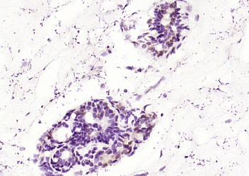 MEK1 + MEK2 Rabbit Polyclonal Antibody