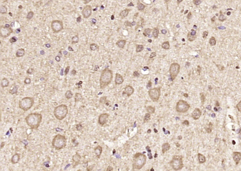 AMPK alpha 2 Rabbit Polyclonal Antibody